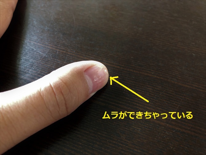 削りムラができちゃった親指の爪
